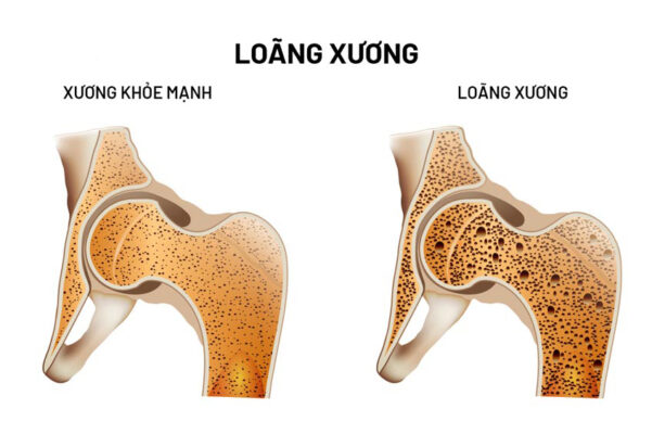 Vì sao người lớn tuổi nên ăn nhạt hơn